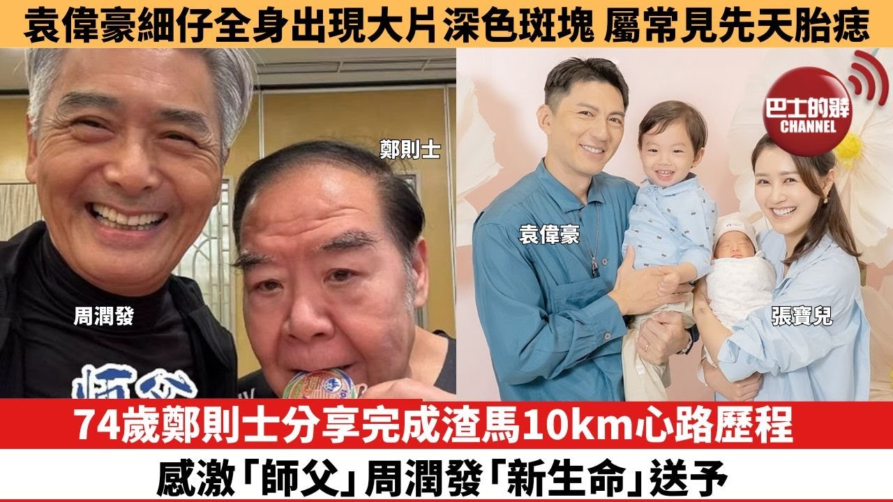 【娛樂焦點】74歲鄭則士分享完成渣馬10km心路歷程，感激「師父」周潤發送予「新生命」。袁偉豪細仔全身出現大片深色斑塊，屬常見先天胎痣。